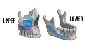 시각화
상악과 하악의 해부학적 위험 구조 비교 다이어그램
sinus_vs_nerve_structure.jpg
상악과 하악의 해부학적 위험 구조 비교 다이어그램